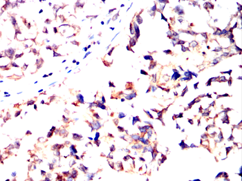 GLS2 Antibody