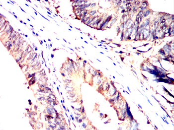 GLS2 Antibody