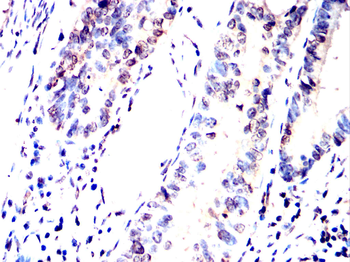 GLS2 Antibody