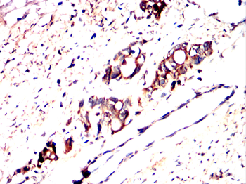 GLS2 Antibody