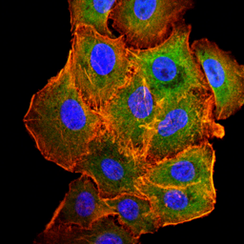 XRN1 Antibody
