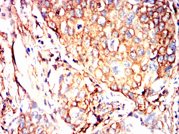 XRN1 Antibody