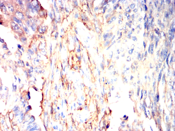 XRN1 Antibody