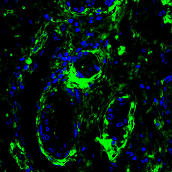 XRN1 Antibody