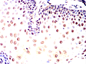 SMARCA4 Antibody