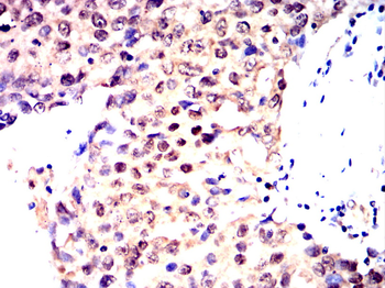 SMARCA4 Antibody