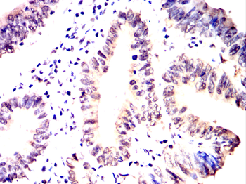 SMARCA4 Antibody