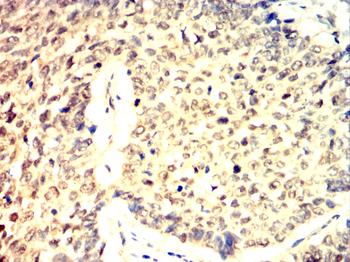 TRIM28 Antibody