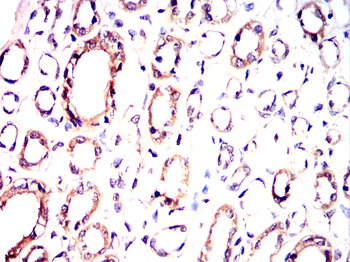 MAPK9 Antibody