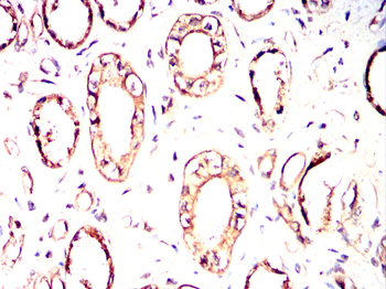 HPRT1 Antibody