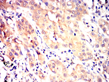 HPRT1 Antibody