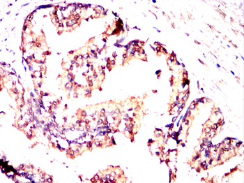 HPRT1 Antibody