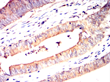 DSG2 Antibody