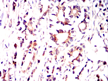 DSG2 Antibody