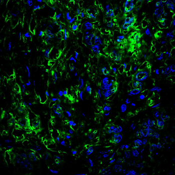 HP Antibody