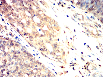 HP Antibody