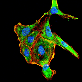 UBE2I Antibody
