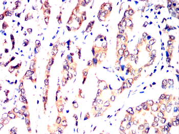 UBE2I Antibody