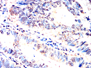 UBE2I Antibody