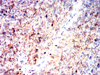 UBE2I Antibody