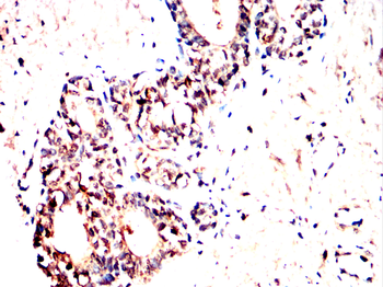 UBE2I Antibody