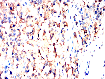 UBE2I Antibody