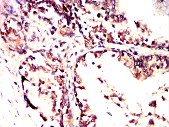 RAB23 Antibody