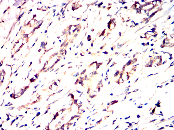RAB23 Antibody