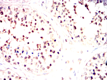 VRK1 Antibody