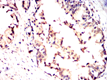 VRK1 Antibody