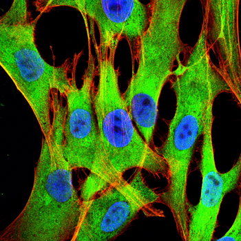 LRRK2 Antibody