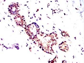 RBM6 Antibody