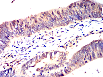 RBM6 Antibody