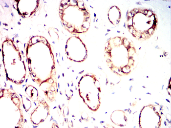 RBM6 Antibody