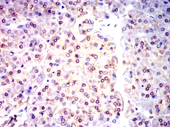 RBM6 Antibody