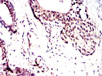 RBM6 Antibody