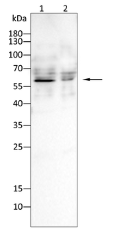 RBM6 Antibody