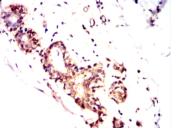 RBCK1 Antibody