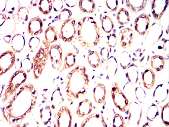 RBCK1 Antibody