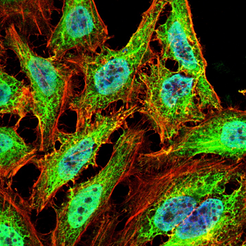 SUMO3 Antibody