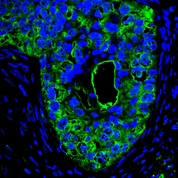 SUMO3 Antibody