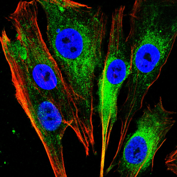 URM1 Antibody