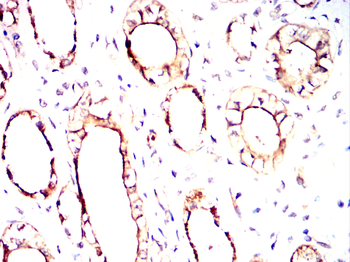 TGM2 Antibody