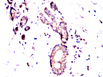 TGM2 Antibody