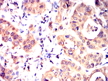 TGM2 Antibody