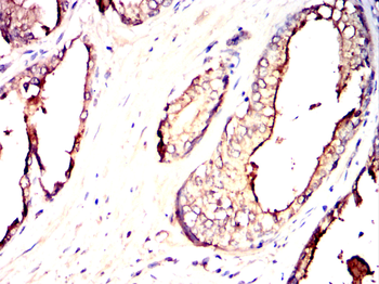 GDF15 Antibody