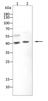 SERPINB3 Antibody