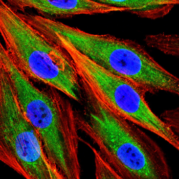SPARC Antibody