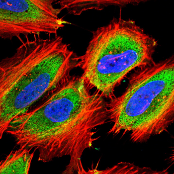 SUV39H1 Antibody