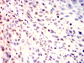 SUV39H1 Antibody